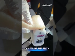 Prova energetica HIFU