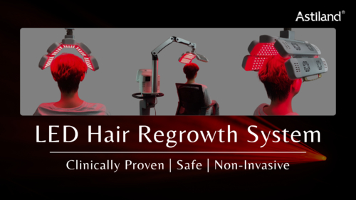 Latest company news about Scegliere la giusta soluzione per la crescita dei capelli basata sulla luce: Scopri la tecnologia di ricrescita dei capelli a LED di Astiland