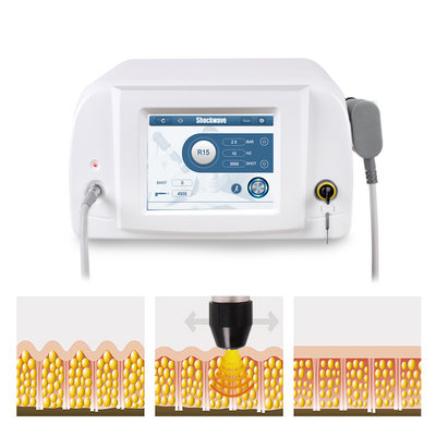 La macchina grassa di terapia di Shockwave di rimozione riduce l'ente grasso ed esile